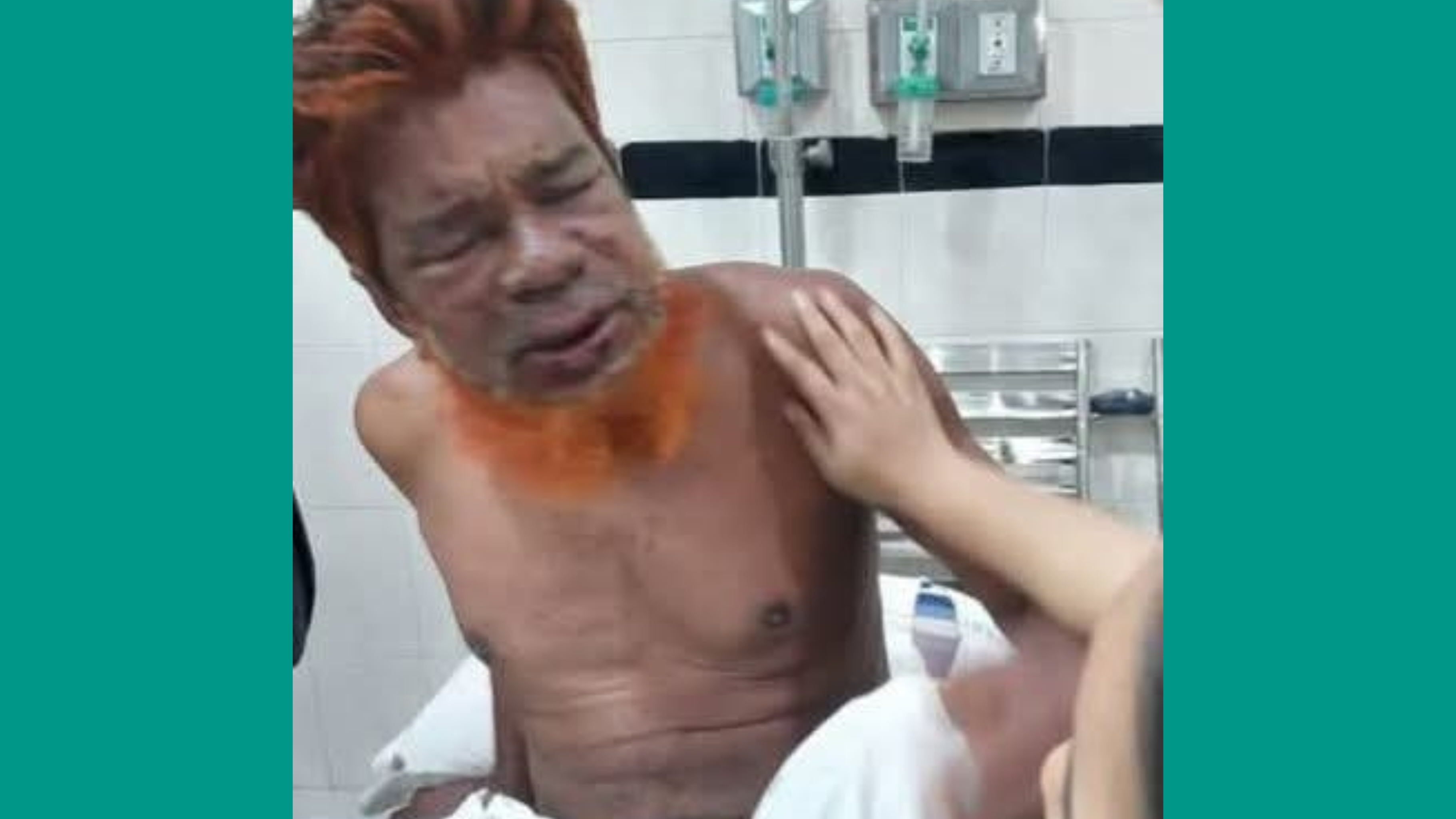 মতলব উত্তরে ভিমরুলের কামড়ে তিনজন হতাহত