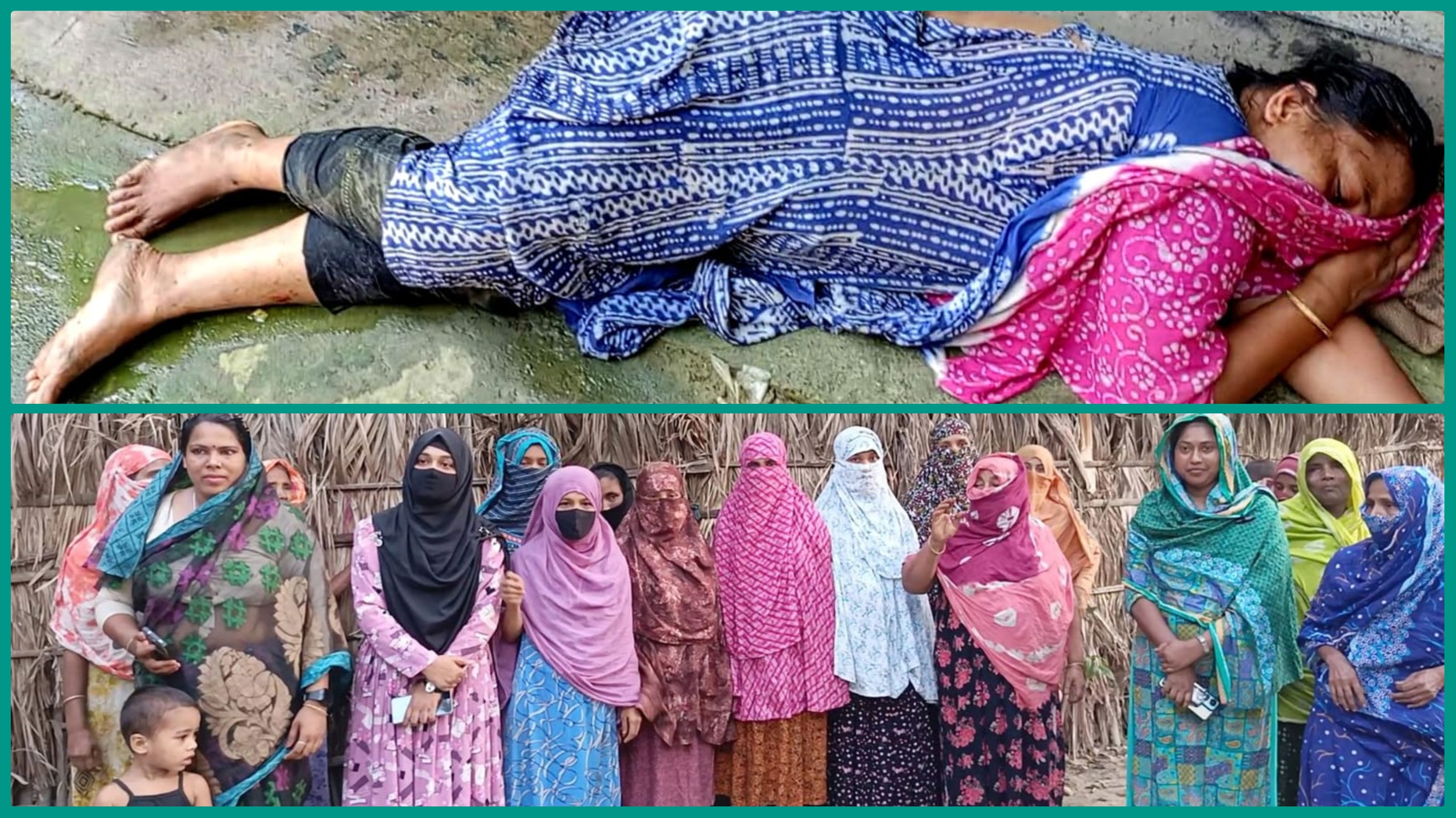 স্বামী-সতিনের ছোড়া গরম পানিতে ঝলসে গেলো গৃহবধূর শরীর