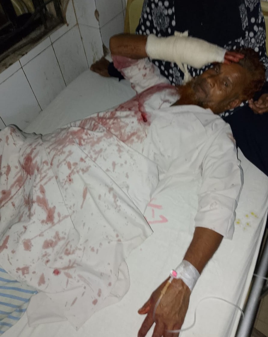 কোরবানির পশু বিক্রিতে চাঁদা না পেয়ে বৃদ্ধকে কুপিয়ে জখমের অভিযোগ