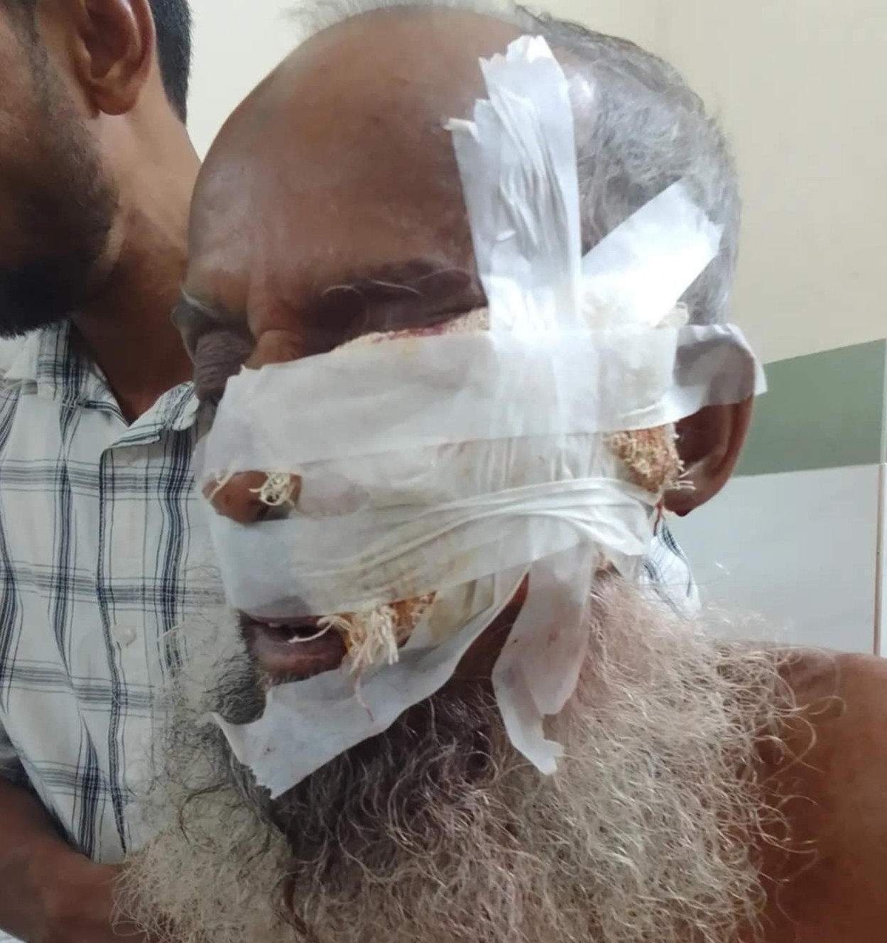 হাজীগঞ্জে ভোরে শিয়ালের কামড়ে আহত ১০