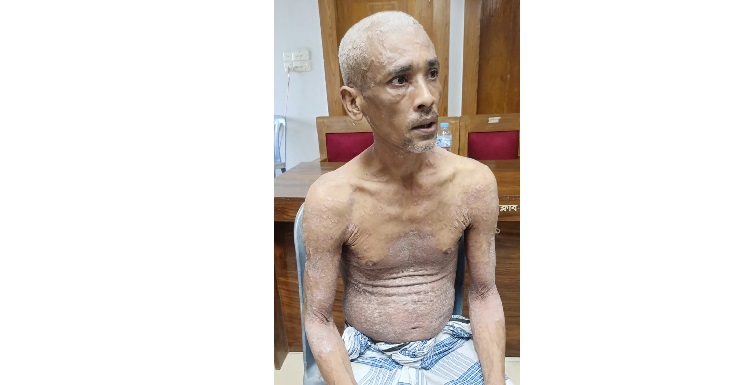 ২৫ বছর ধরে স্কিন সিরোসিসে আক্রান্ত ফারুকের সাহায্যের আবেদন