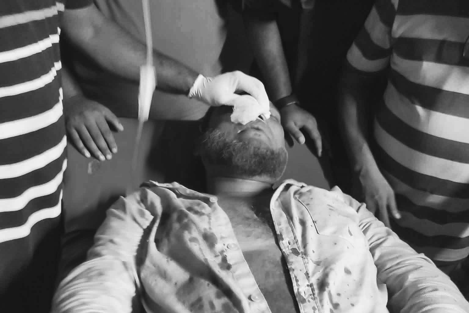 রামগঞ্জে ইউনিয়ন বিএনপির প্রতিনিধি নির্বাচনে ব্যাপক সংঘর্ষে প্রিসাইডিং অফিসার সহ আহত ৫
