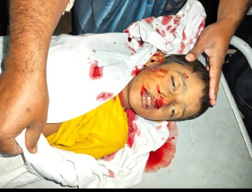 রায়পুরে অটোরিকশার ধাক্কায় শিশু নিহত