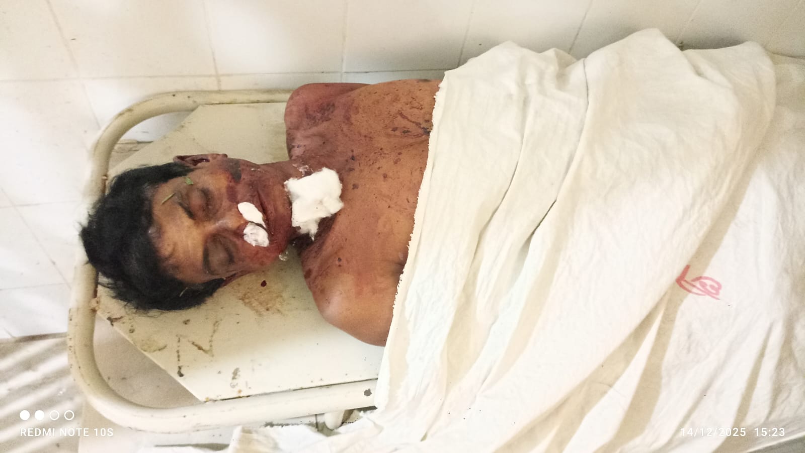 বাকিলায় অটোবাইক উল্টে যাত্রীর মৃত্যু