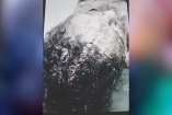 ১০ সেলাই আর শ্লীলতাহানির ধাক্কায় বিছানায় কাতরাচ্ছে এক নারী