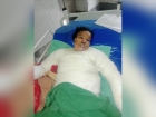 ফরিদগঞ্জে গৃহবধূকে পুড়িয়ে হত্যাচেষ্টা ॥ নারী সুদ ব্যবসায়ী আটক