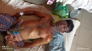 পরকীয়ার জেরে  ঘুমন্ত  স্বামীর ওপর স্ত্রীর এসিড নিক্ষেপ