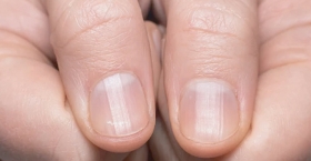 সবুজ নখ : বিলাস নয় ব্যাধি