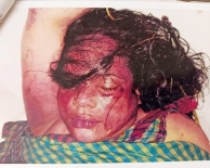 ৮ মাস পূর্বে  অজ্ঞাত তরুণীর লাশ উদ্ধার : ময়নাতদন্তে হত্যার আলামত