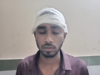 মান্দারীতে হামলায় আহত ৩