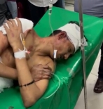 সন্ত্রাসী হামলায় আহত আরমান।। মামলার আসামি গ্রেপ্তার হবে কবে?