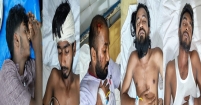 বলাখালে অজ্ঞাতদের হামলায় ১০ পরিবহন শ্রমিক আহত