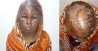 শাহরাস্তিতে মাথায় ১৪ সেলাই নিয়ে মাদকাসক্ত ছেলের বিরুদ্ধে মায়ের মামলা