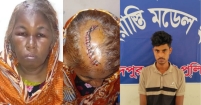শাহরাস্তিতে মাথায় ১৪ সেলাই নিয়ে মাদকাসক্ত ছেলের বিরুদ্ধে মায়ের মামলা