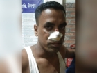 কচুয়ায় চাঁদা না দেয়ায় সেনা সদস্যকে পিটিয়ে পা ভাঙার অভিযোগ, ৩ জন গ্রেফতার