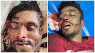 ফরিদপুরে সড়ক দুর্ঘটনায় চাঁদপুরের যুবক সহ ২ জন নিহত